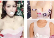 丰胸整形医院哪里好,专业、安全、口碑佳，助您重塑自信曲线”