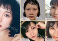 重庆整形,前沿技术、专家团队与优质服务全景解析