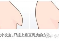 胸部下垂整形术,胸部下垂整形术的多样选择与效果解析